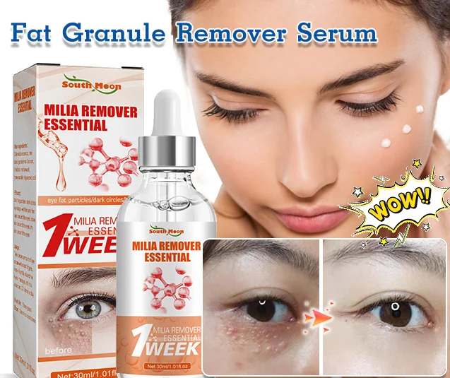 South Moon Fat Granule Remover Serum