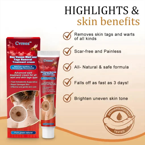 Cvreoz Bee Venom Wart and Tags Removal Treatment Cream