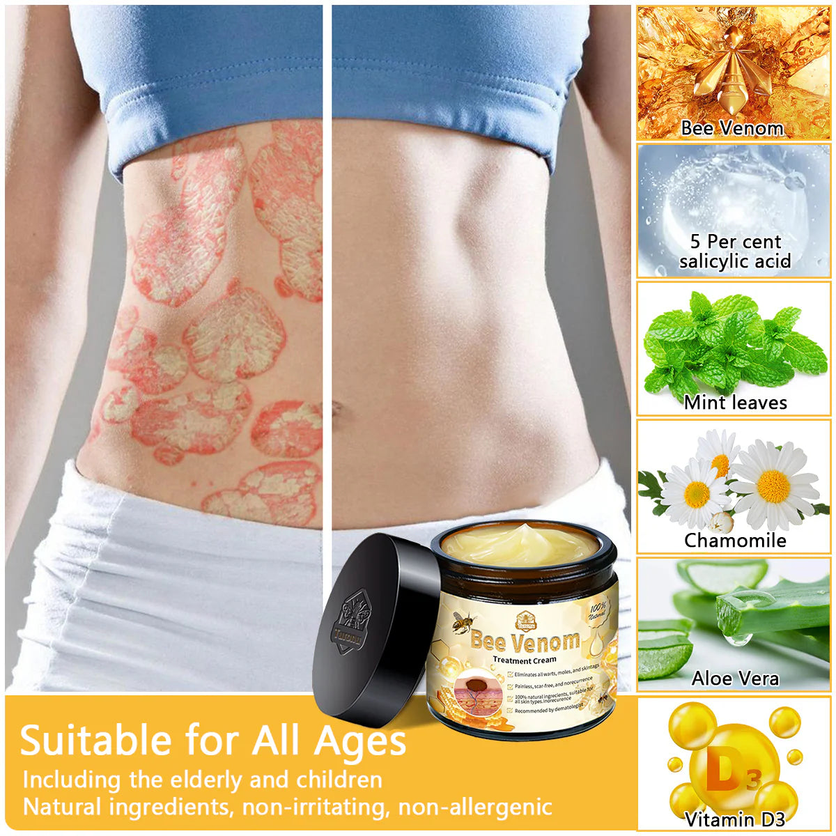 【Made in USA】𝑇𝑢𝑟𝑜𝑛𝑢™ Bee Venom Skin Treatment Cream