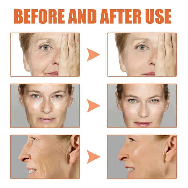 Tiworld™ Rapid Anti Wrinkle Serum, Face Lift Cream, Instant Wrinkle Remover for Face, Eye Bag and Neck, Wrinkle Cream for Face Deep Wrinkles