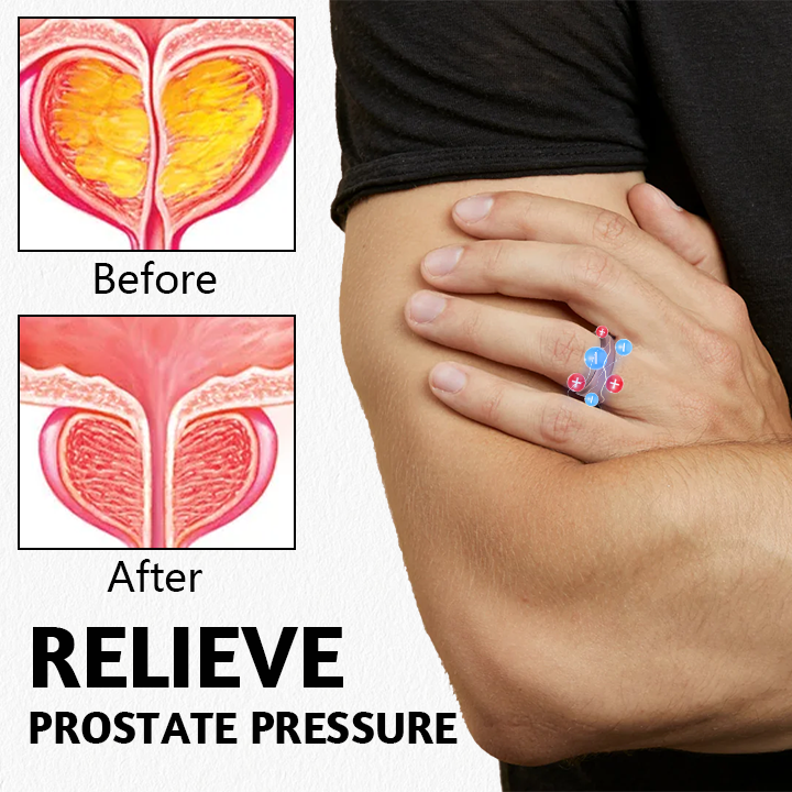 🔥LAST DAY Promotion 48% OFF🔥 Miniyou™ ProstaMagnetic Harmony Ring