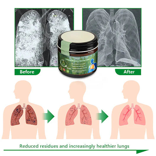 Lercea™ Mullein Lung Cleansing and Restoring Cream