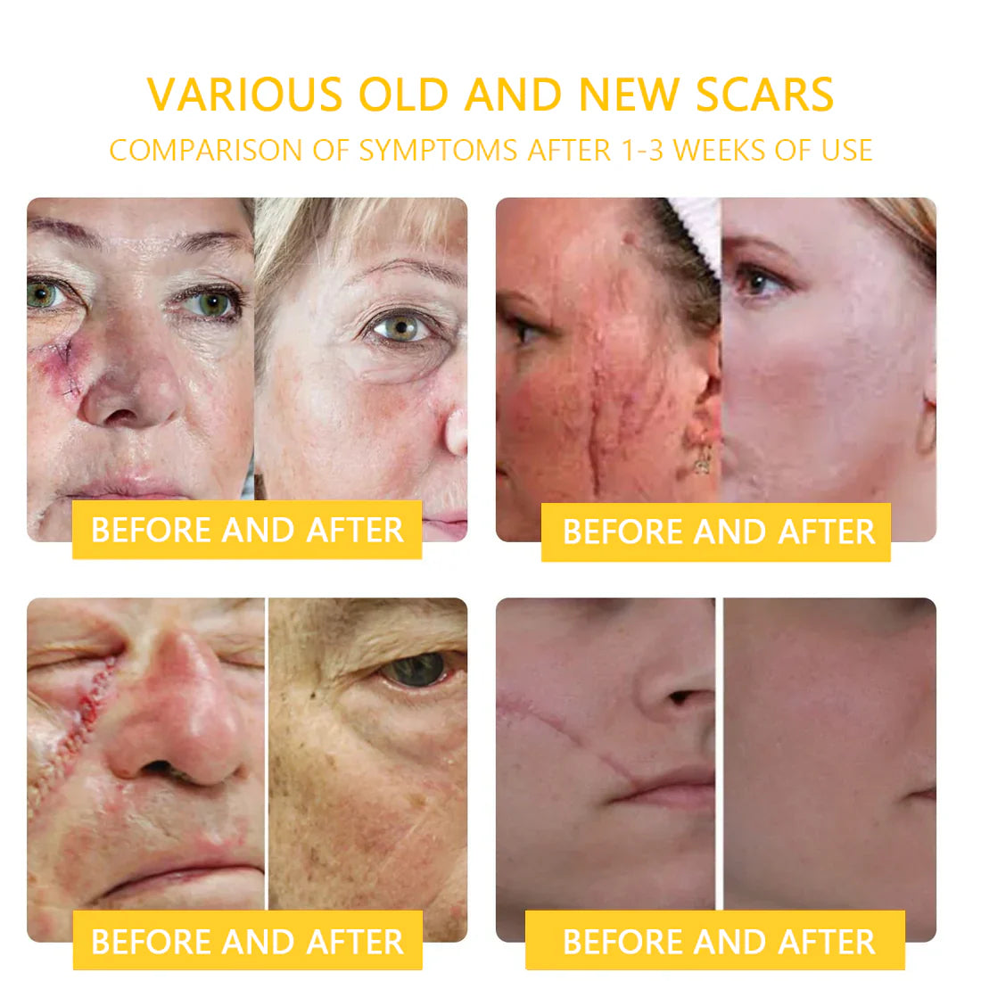 【Made in USA】𝑇𝑢𝑟𝑜𝑛𝑢™ Bee Venom Skin Treatment Cream