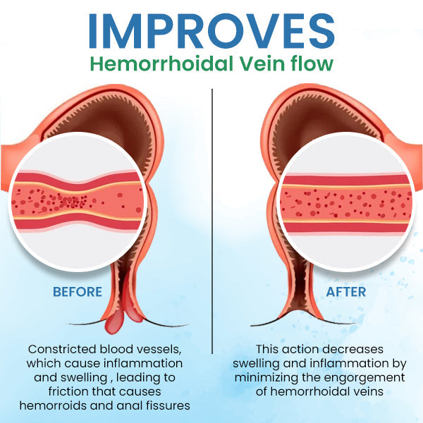 Quezy™ Hemorrhoids Treatment Gel