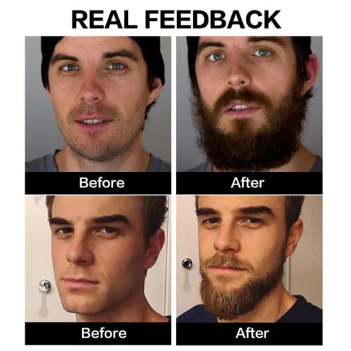 ELAIMEI™ Beard Growth Organic Care Oil