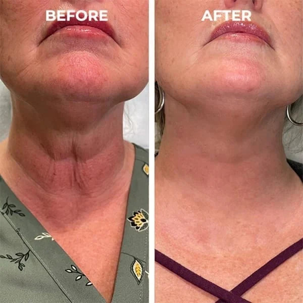Tiworld™ Rapid Anti Wrinkle Serum, Face Lift Cream, Instant Wrinkle Remover for Face, Eye Bag and Neck, Wrinkle Cream for Face Deep Wrinkles