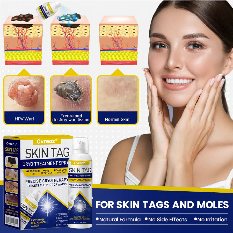 ⏰Last Day Promotion: 60% OFF🔥 Cvreoz® Skin Tag Cryo Treatment Spray