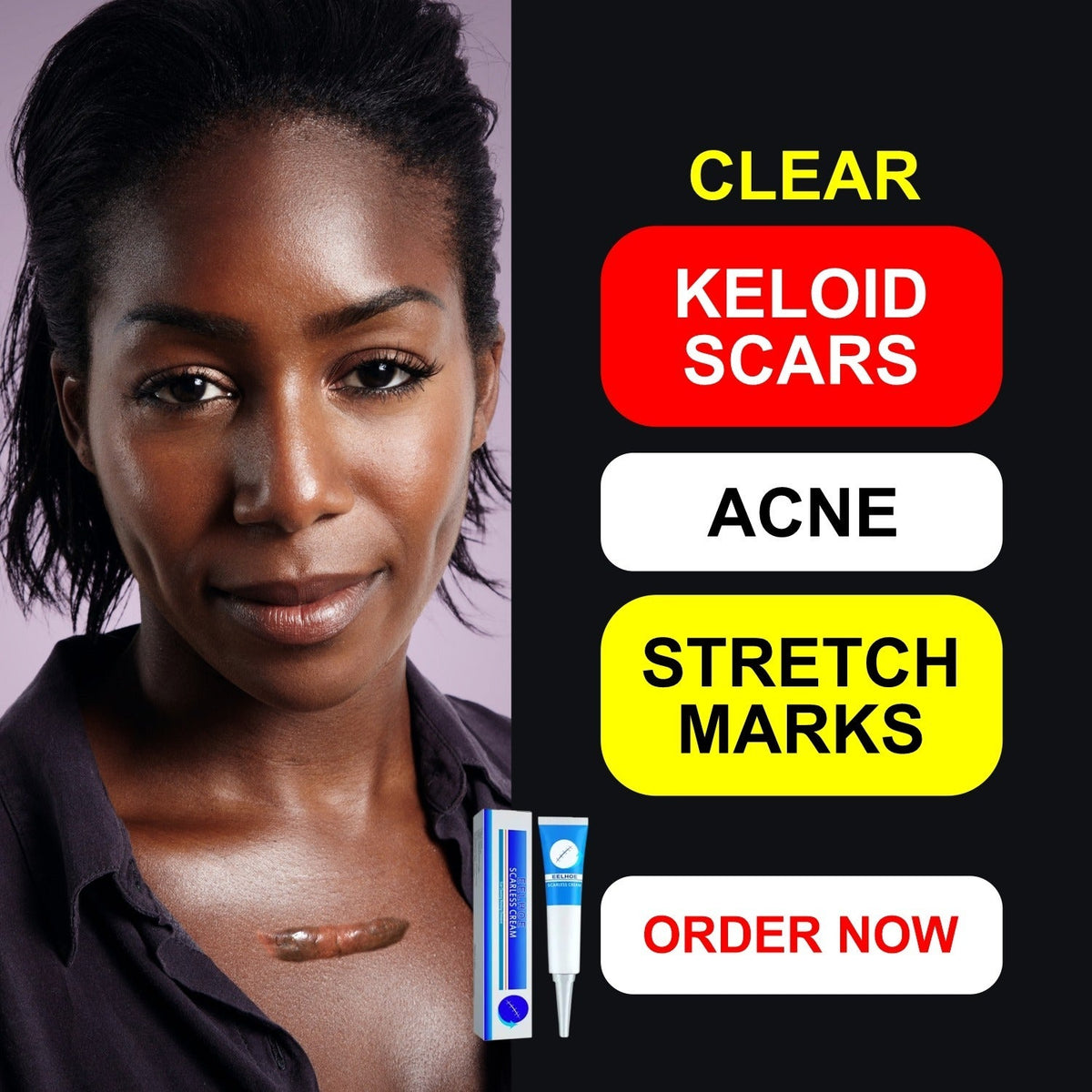 BEST SCAR REMOVER CREAM™【buy one get one free】